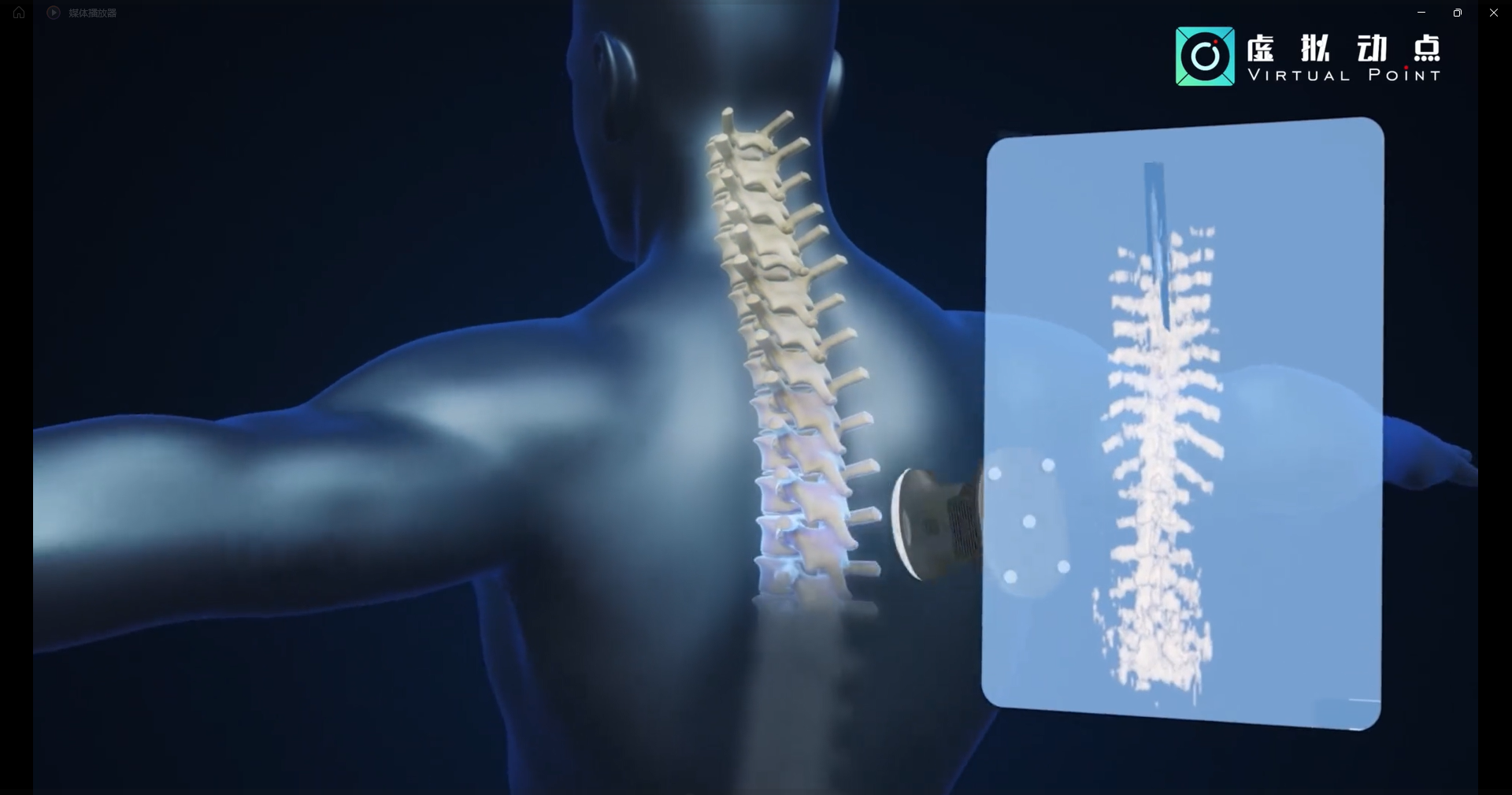 金年会·jinnian(金子招牌)·虚拟动点OptiTrack开创3D超声成像在脊柱诊断中的应用